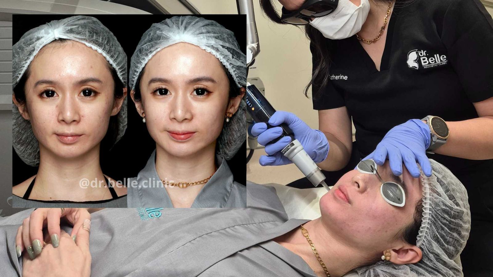 Wajah Cerah di Setiap Langkah: dr. YENNY BEAUTY CENTER